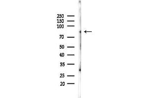Western blot analysis of lysates from Mouse lung, using ANKK1 Antibody at 1/1000 dilution.