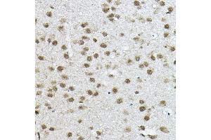 Immunohistochemistry (IHC) image for anti-Nuclear Receptor Co-Repressor 2 (NCOR2) (AA 670-900) antibody (ABIN6144422)