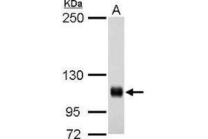 WB Image Rb antibody detects Rb protein by western blot analysis. (Retinoblastoma 1 Antikörper  (C-Term))
