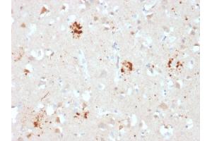 Formalin-fixed, paraffin-embedded human Brain stained with Ubiquitin Mouse Monoclonal Antibody (UBB/2122). (Ubiquitin B Antikörper  (AA 1-119))