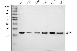 Western blot analysis of EIF5A using anti-EIF5A antibody (ABIN7602568).