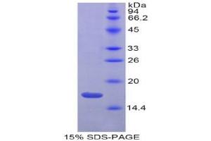 SDS-PAGE (SDS) image for Gastrokine 3 (GKN3) (AA 38-177) protein (His tag) (ABIN2121109) (Gastrokine 3 Protein (GKN3) (AA 38-177) (His tag))