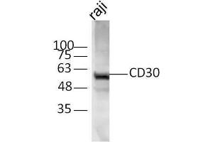 Western Blotting (WB) image for anti-Tumor Necrosis Factor Receptor Superfamily, Member 8 (TNFRSF8) (AA 131-230) antibody (ABIN741090)