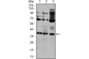 Western blot analysis using CIDEC mouse mAb against HEK293 (1), A431 (2), and HCT116 (3) cell lysate. (CIDEC Antikörper  (AA 53-141))