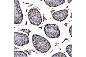 IHC analysis of SAP130 using anti-SAP130 antibody (ABIN7601247). (SAP130 Antikörper  (AA 309-913))