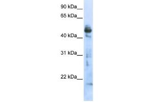 Western Blotting (WB) image for anti-3-Oxoacyl-ACP Synthase, Mitochondrial (OXSM) antibody (ABIN2459003)
