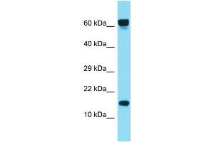 Host: Rabbit Target Name: C1orf86 Sample Type: ACHN Whole cell lysates Antibody Dilution: 1. (C1orf86 Antikörper  (C-Term))