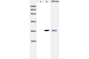 L2 rat heart lysates probed with Anti Lambda Light Chain Polyclonal Antibody, Unconjugated (ABIN704321) at 1:200 overnight at 4 °C. (Lambda-IgLC Antikörper  (AA 41-106))