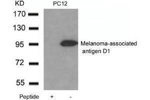 Western blot analysis of extracts from PC12 cells using Melanoma-associated antigen D1 Antibody and the same antibody preincubated with blocking peptide. (MAGED1 Antikörper)