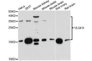Western blot analysis of extracts of various cell lines, using VEGFA antibody. (VEGFA Antikörper  (AA 111-161))