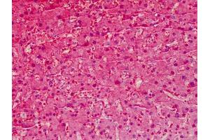 Human Liver: Formalin-Fixed, Paraffin-Embedded (FFPE)