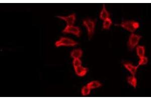 ABIN6275682 staining 293 by IF/ICC. (WASF2 Antikörper  (Internal Region))