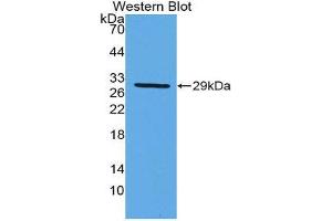 Western Blotting (WB) image for anti-Damage-Specific DNA Binding Protein 2, 48kDa (DDB2) (AA 166-383) antibody (ABIN1980395) (DDB2 Antikörper  (AA 166-383))