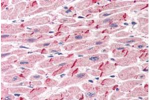 Human Heart (formalin-fixed, paraffin-embedded) stained with JUP antibody ABIN305904 at 5 ug/ml followed by biotinylated anti-goat IgG secondary antibody ABIN481715, alkaline phosphatase-streptavidin and chromogen. (JUP Antikörper  (AA 732-745))