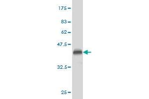 Western Blot detection against Immunogen (36. (Phospholipase D2 Antikörper  (AA 834-933))