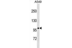 Western Blotting (WB) image for anti-Fanconi Anemia, Complementation Group B (FANCB) antibody (ABIN5019480)