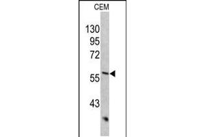 Western blot analysis of KRT10 antibody in CEM cell line lysates (35ug/lane) (Keratin 10 Antikörper  (AA 318-346))