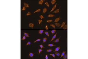 Immunofluorescence analysis of L929 cells using Kininogen 1 (Kininogen 1 (KNG1)) Rabbit pAb (ABIN3022363, ABIN3022364, ABIN3022365 and ABIN6218762) at dilution of 1:100 (40x lens).
