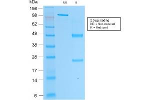 SDS-PAGE Analysis Purified PSAP Mouse Monoclonal Antibody (rACPP/1338). (Rekombinanter ACPP Antikörper)