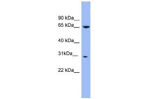 WB Suggested Anti-NDUFS3 Antibody Titration: 0. (NDUFS3 Antikörper  (Middle Region))