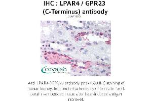 Image no. 1 for anti-Lysophosphatidic Acid Receptor 4 (LPAR4) (C-Term) antibody (ABIN1736524) (LPAR4 Antikörper  (C-Term))