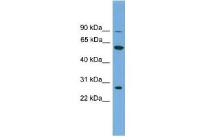 WB Suggested Anti-IMPDH2 Antibody Titration: 0. (IMPDH2 Antikörper  (N-Term))