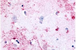 Anti-PAK6 antibody  ABIN1049227 IHC staining of human brain, neurons and glia.