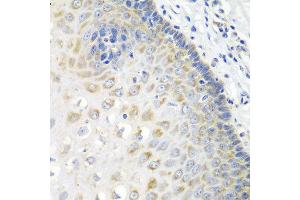 Immunohistochemistry of paraffin-embedded human esophagus using STXBP4 antibody at dilution of 1:100 (40x lens). (STXBP4 Antikörper)