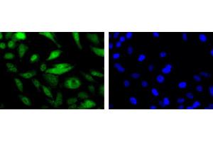 Image no. 4 for anti-MRE11 Meiotic Recombination 11 Homolog A (S. Cerevisiae) (MRE11A) antibody (ABIN363310)