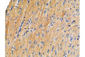 ABIN6257863 and ABIN6275053 at 1/100 staining Rat heart tissue by IHC-P.