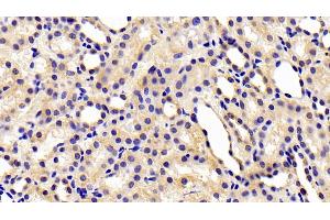 Detection of CHEM in Rat Kidney Tissue using Polyclonal Antibody to Chemerin (CHEM) (Chemerin Antikörper  (AA 25-152))