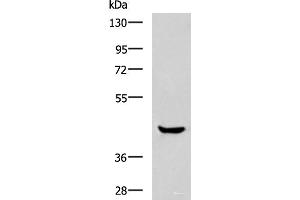 Western blot analysis of Human muscle tissue lysate using HOXA2 Polyclonal Antibody at dilution of 1:800