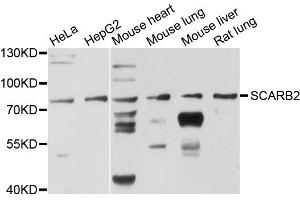 Western blot analysis of extracts of various cell lines, using SCARB2 antibody. (SCARB2 Antikörper)