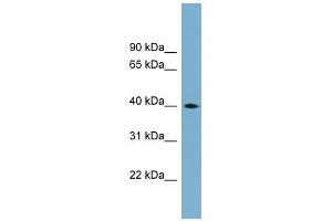 WB Suggested Anti-TSPAN17 Antibody Titration:  0. (Tetraspanin 17 Antikörper  (Middle Region))