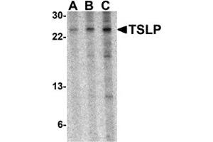 Western Blotting (WB) image for anti-Thymic Stromal Lymphopoietin (TSLP) (Middle Region) antibody (ABIN1031148) (Thymic Stromal Lymphopoietin Antikörper  (Middle Region))
