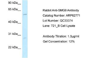 Western Blotting (WB) image for anti-Smg-9 Homolog, Nonsense Mediated mRNA Decay Factor (SMG9) (N-Term) antibody (ABIN2789240) (SMG9 Antikörper  (N-Term))