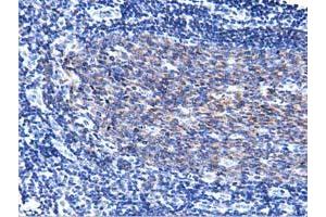 Immunohistochemical staining of paraffin-embedded Human lymph node tissue using anti-PIK3AP1 mouse monoclonal antibody. (PIK3AP1 Antikörper)