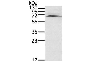 Western Blot analysis of Human normal kidney tissue using CYP11A1 Polyclonal Antibody at dilution of 1:200 (CYP11A1 Antikörper)