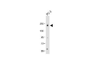 SPAG9 Antikörper  (N-Term)