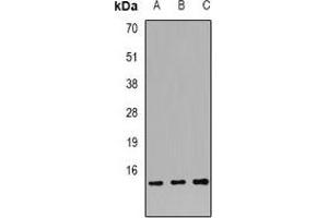 Western blot analysis of S100-A12 expression in HL60 (A), SW620 (B), K562 (C) whole cell lysates. (S100A12 Antikörper)
