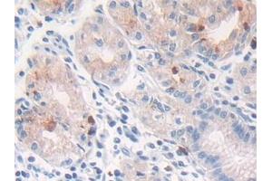 Immunohistochemistry (IHC) image for anti-Cathepsin G (CTSG) (AA 21-255) antibody (ABIN7435688)