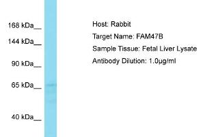 Host: Rabbit Target Name: FAM47B Sample Type: Fetal Liver lysates Antibody Dilution: 1. (FAM47B Antikörper  (C-Term))