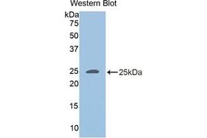 Detection of Recombinant ADRP, Human using Polyclonal Antibody to Adipose Differentiation Related Protein (ADRP) (ADRP Antikörper  (AA 245-433))