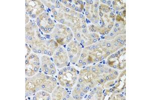 Immunohistochemistry (Paraffin-embedded Sections) (IHC (p)) image for anti-Usher Syndrome 1C (Autosomal Recessive, Severe) (USH1C) (AA 1-100) antibody (ABIN1683223)