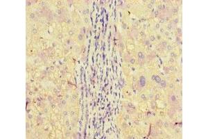 Immunohistochemistry of paraffin-embedded human liver tissue using ABIN7150160 at dilution of 1:100 (APOBEC3G Antikörper  (AA 1-384))