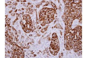 IHC-P Image Immunohistochemical analysis of paraffin-embedded A549 xenograft, using AGR3, antibody at 1:500 dilution.