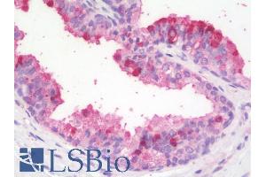 ABIN5539919 (5µg/ml) staining of paraffin embedded Human Prostate. (ZBTB24 Antikörper  (AA 232-245))