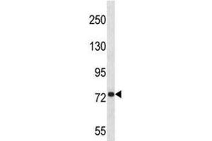 Anti-APP antibody western blot analysis in 293 lysate (APP Antikörper  (AA 333-362))