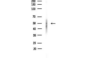 Western blot analysis of lysates from Hela cells(heat-shock,45 min treatment), using Nicotinic Acetylcholine Receptor alpha 7 Antibody at 1/1000 dilution.