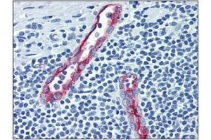 Immunohistochemistry (IHC) image for anti-Selectin P (Granule Membrane Protein 140kDa, Antigen CD62) (SELP) antibody (ABIN316863) (P-Selectin Antikörper)